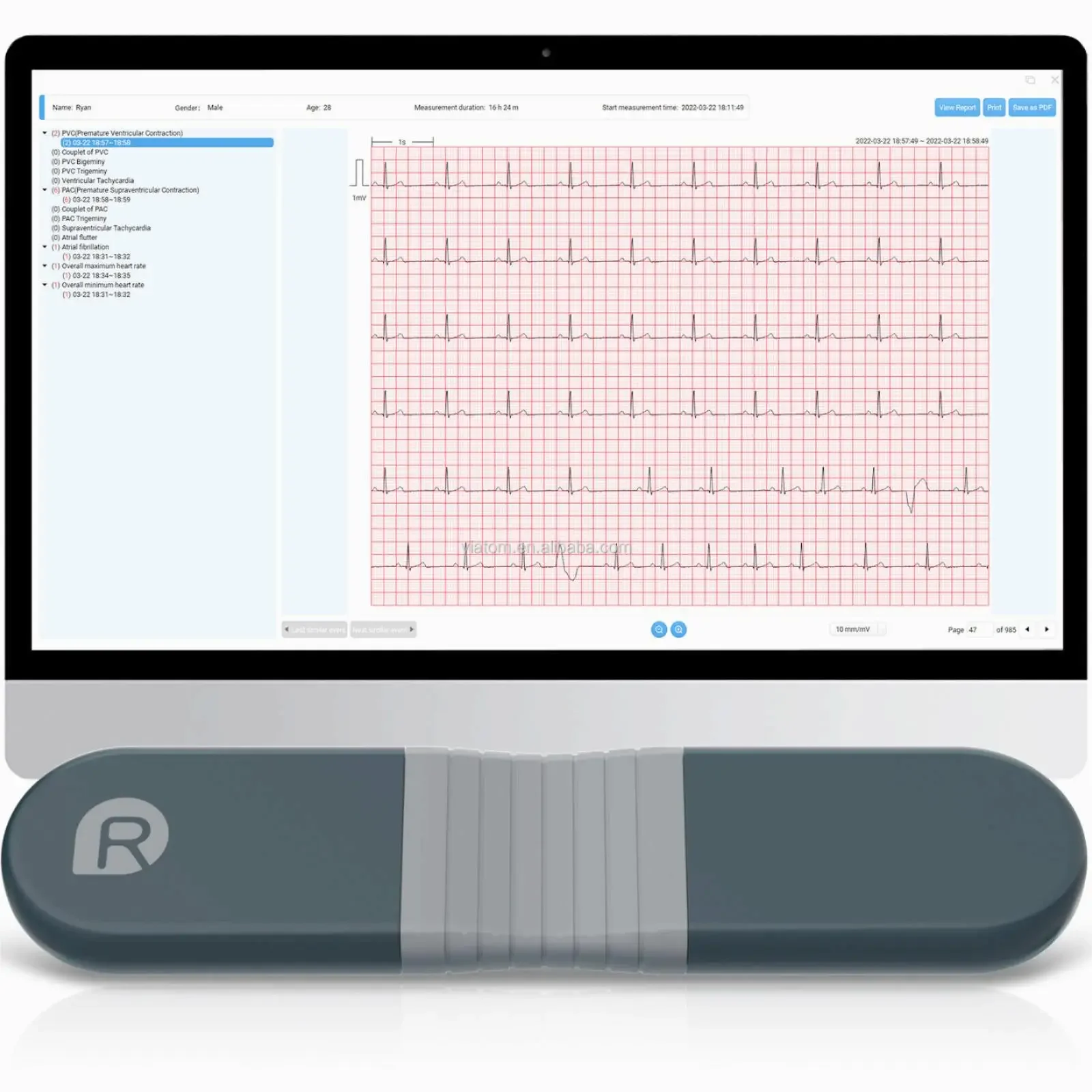 Wireless Bluetooth Dynamic Rec - Ecg Patch Monitor recensie en prijs